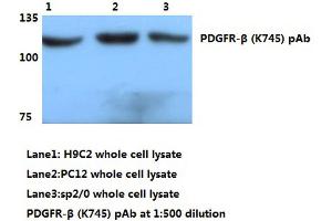 Western blot (WB) analyzes of PDGFR-β antibody (PDGFRB anticorps)