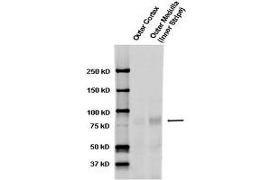 Western blot analysis of Rat kidney tissue lysates showing detection of ENaC protein using Rabbit Anti-ENaC Polyclonal Antibody . (SCNN1A anticorps  (AA 46-68) (Atto 594))