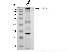 Western blot analysis of Plectin using anti-Plectin antibody (ABIN3043900). (PLEC anticorps  (Middle Region))