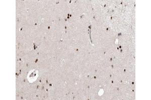 ABIN6266648 at 1/100 staining human brain tissue sections by IHC-P.