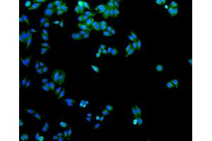 Immunofluorescence analysis of HepG2 cells using SLC2A1 antibody (ABIN5997113). (GLUT1 anticorps)