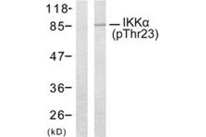 Western blot analysis of extracts from MDA-MB-435 cells treated with EGF, using IKK-alpha (Phospho-Thr23) Antibody. (IKK alpha anticorps  (pThr23))