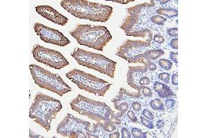 anti-Interferon alpha/beta Receptor 2 (IFNAR2) (AA 33-466) antibody