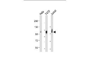 All lanes : Anti-LP2 Antibody at 1:2000-8000 dilution Lane 1: HeLat whole cell lysate Lane 2: T47D whole cell lysate Lane 3: Jurkat whole cell lysate Lysates/proteins at 20 μg per lane. (LAMP2 anticorps)