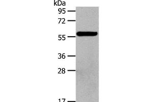 Western Blot analysis of Hela cell using HDAC7 Polyclonal Antibody at dilution of 1:100 (HDAC7 anticorps)