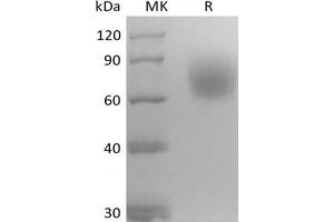 Western Blotting (WB) image for Neurotrophic Tyrosine Kinase, Receptor, Type 2 (NTRK2) protein (His tag) (ABIN7320912) (TRKB Protein (His tag))