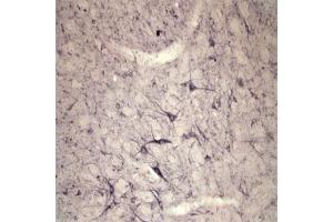 IHC on rat spinal cord using Rabbit antibody to extracellular, N-terminal part of Sortilin (Neurotensin receptor 3, NTR3, Sort1): IgG  at a concentration of 10 µg/ml. (Sortilin 1 anticorps)