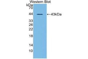 Western blot analysis of the recombinant protein. (Ghrelin anticorps  (AA 28-117))