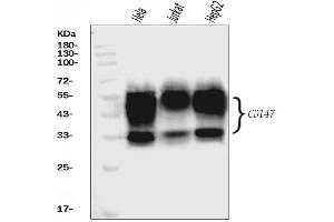 Western blot analysis of CD147/Emmprin using anti-CD147/Emmprin antibody (ABIN7599998).