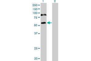 Western Blot analysis of RBM6 expression in transfected 293T cell line by RBM6 monoclonal antibody (M16), clone 4B3. (RBM6 anticorps  (AA 1024-1123))
