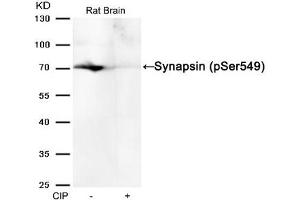 Western blot analysis of extracts from Rat brain tissue or calf intestinal phosphatase (CIP), using Synapsin (phospho-Ser549) Antibody. (SYN1 anticorps  (pSer549))