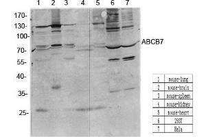 Western Blot (WB) analysis of specific cells using antibody diluted at 1:1000. (ABCB7 anticorps  (C-Term))