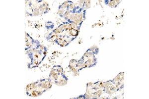 Immunohistochemistry of paraffin-embedded Human placenta using IGF1 antibody (ABIN1682184, ABIN3015345, ABIN3015346 and ABIN7101347) at dilution of 1:100 (40x lens). (IGF1 anticorps)