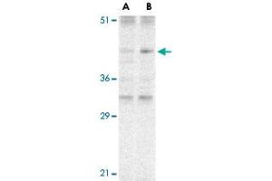 Western blot analysis of CARD8 expression in K-562 cell lysate with CARD8 polyclonal antibody  at (A) 2 and (B) 4 ug /mL . (CARD8 anticorps  (C-Term))