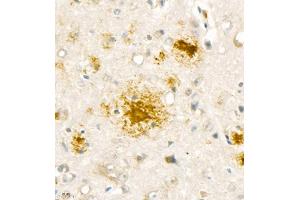 Immunohistochemistry analysis of paraffin embedded mouse Alzheimer',s brain using Aβ40 (ABIN7073042) at dilution of 1:1000 (Abeta 1-40 anticorps)