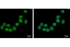 ICC/IF Image ZNF45 antibody [N2C3] detects ZNF45 protein at nucleus by immunofluorescent analysis.