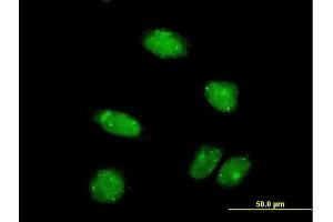 Immunofluorescence of monoclonal antibody to PIAS2 on HeLa cell.