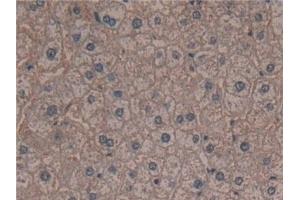 Detection of RPS6Ka1 in Human Liver Tissue using Polyclonal Antibody to Ribosomal Protein S6 Kinase Alpha 1 (RPS6Ka1)