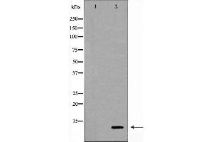 Western blot analysis of extracts of THP-1 , using CSTA antibody. (CSTA anticorps  (C-Term))