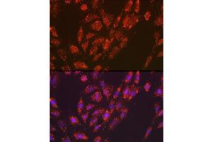 Immunofluorescence analysis of C6 cells using Versican Rabbit mAb (ABIN7271309) at dilution of 1:100 (40x lens).
