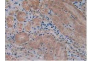 IHC-P analysis of Mouse Kidney Tissue, with DAB staining. (TCF20 anticorps  (AA 1871-1965))