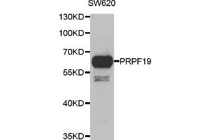 Western blot analysis of extracts of SW620 cells, using PRPF19 antibody (ABIN5974049) at 1/1000 dilution. (PRP19 anticorps)
