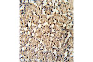 Formalin-fixed and raffin-embedded mouse kidney reacted with X8 Antibody (Center), which was peroxidase-conjugated to the secondary antibody, followed by DAB staining.