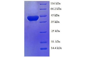 SDS-PAGE (SDS) image for Carbonic Anhydrase I (CA1) (AA 2-261), (full length) protein (His tag) (ABIN7479141)