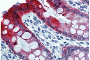 Colon, Human: Formalin-Fixed, Paraffin-Embedded (FFPE)