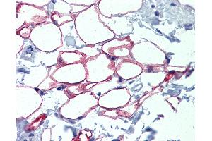Anti-NFIC antibody IHC of normal human adrenal (adipocytes).