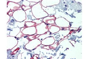 Anti-NFIC antibody IHC of normal human adrenal (adipocytes). (NFIC anticorps  (AA 323-372))