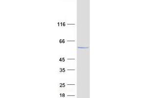 Validation with Western Blot
