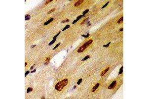 Immunohistochemical analysis of PSMC2 staining in mouse heart formalin fixed paraffin embedded tissue section.
