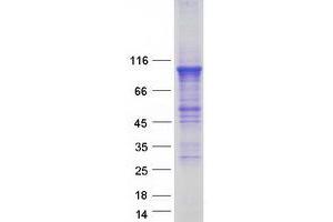 Validation with Western Blot