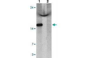Western blot analysis of C1orf64 in HeLa cell lysate with C1orf64 polyclonal antibody  at 1 ug/mL in (lane 1) the absence and (lane 2) the presence of blocking peptide. (C1orf64 anticorps  (C-Term))