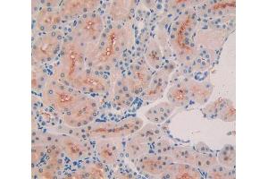 IHC-P analysis of kidney tissue, with DAB staining. (COL3A1 anticorps  (AA 1171-1435))