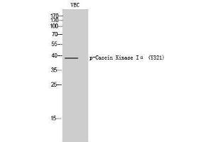 Western Blotting (WB) image for anti-Casein Kinase 1, alpha 1 (CSNK1A1) (pTyr321) antibody (ABIN3182288) (CSNK1A1 anticorps  (pTyr321))