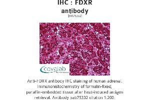 Image no. 2 for anti-Ferredoxin Reductase (FDXR) antibody (ABIN1734312) (Ferredoxin Reductase anticorps)