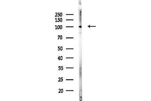 Western blot analysis of lysates from Mouse brain, using EPH Antibody at 1/1000 dilution.