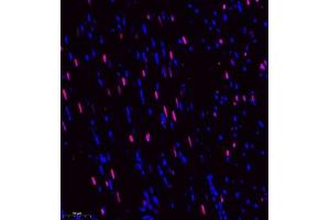 Immunofluorescence of paraffin embedded rat heart using DEPDC1 (ABIN7073717) at dilution of 1:500 (250x lens)