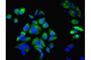 Immunofluorescent analysis of Hela cells using ABIN7157433 at dilution of 1:100 and Alexa Fluor 488-congugated AffiniPure Goat Anti-Rabbit IgG(H+L)