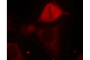 Immunofluorescence staining of methanol-fixed Hela cells using MKK3(Phospho-Ser189) Antibody. (MAP2K3 anticorps  (pSer189))