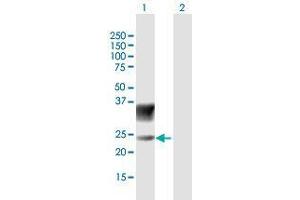 Western Blot analysis of SCN3B expression in transfected 293T cell line by SCN3B MaxPab polyclonal antibody. (SCN3B anticorps  (AA 1-215))