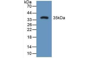 Detection of Recombinant OPN, Rat using Polyclonal Antibody to Osteopontin (OPN) (Osteopontin anticorps  (AA 17-317))
