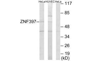 Western blot analysis of extracts from HeLa cells and HUVEC cells, using ZNF397 antibody. (ZNF397 anticorps  (N-Term))