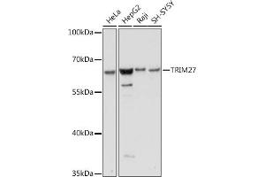 Western blot analysis of extracts of various cell lines, using TRIM27 antibody (ABIN7269922) at 1:1000 dilution. (TRIM27 anticorps  (AA 1-200))