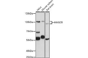 Western blot analysis of extracts of various cell lines, using HMGCR antibody (ABIN6132111, ABIN6141869, ABIN6141870 and ABIN6217262) at 1:1000 dilution. (HMGCR anticorps  (AA 629-888))