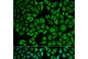 Immunofluorescence analysis of MCF-7 cells using CTSA Polyclonal Antibody (CTSA anticorps)