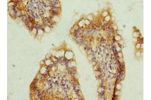 anti-Transmembrane Protein 91 (TMEM91) (AA 1-97) antibody