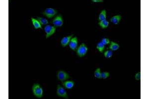 Immunofluorescence staining of Hela cells with ABIN7171862 at 1:100, counter-stained with DAPI.